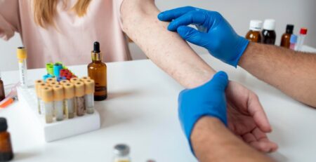 alergie la penicilina blog Farmacia Terrapharm