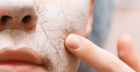 cicatricile si dermatocosmeticele blog Farmacia Terrapharm